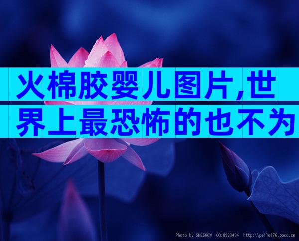 火棉胶婴儿图片,世界上最恐怖的也不为过